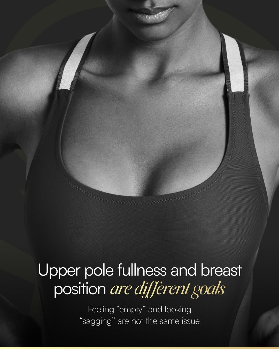 Instagram post by Dr. John Layke, DO: When patients describe their breasts as “empty,” they may be referring to loss of fullness in the upper portion of the breast. When they des…