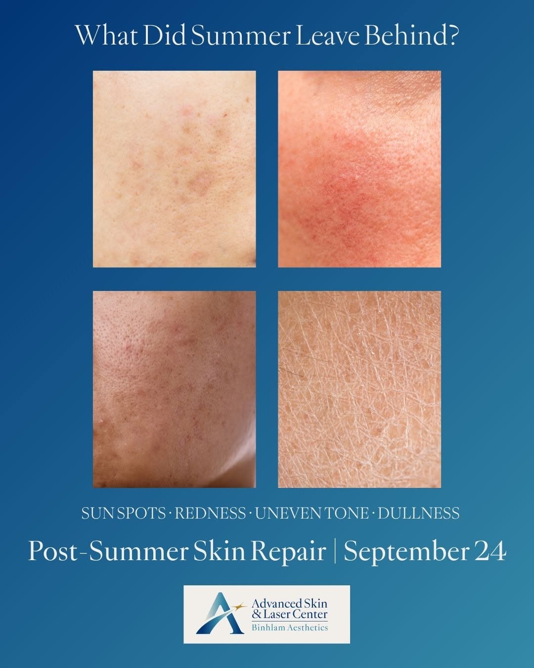 Instagram post by Dr. John Q. Binhlam: Your skin, our passion™ We invite you to join us on September 24th for an opportunity to learn about Post-Summer Skin Repair. We'll help you…