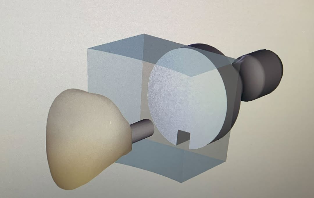 Instagram post by Dr. John Shi: Ever wondered what a dental implant actually looks like beneath the surface? 🦷 At Centre Dental/中央牙科, we use 3D imaging and digital models …