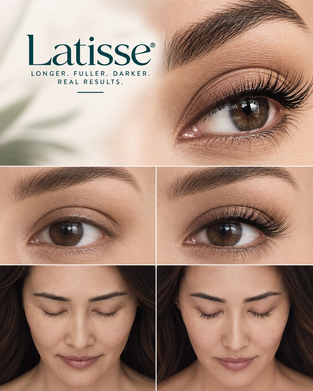 Instagram post by Dr. John Zannis: Your lash era starts now. ✨ For a limited time, enjoy 50% OFF LATISSE® — while supplies last! LATISSE® is the first FDA-approved prescriptio…