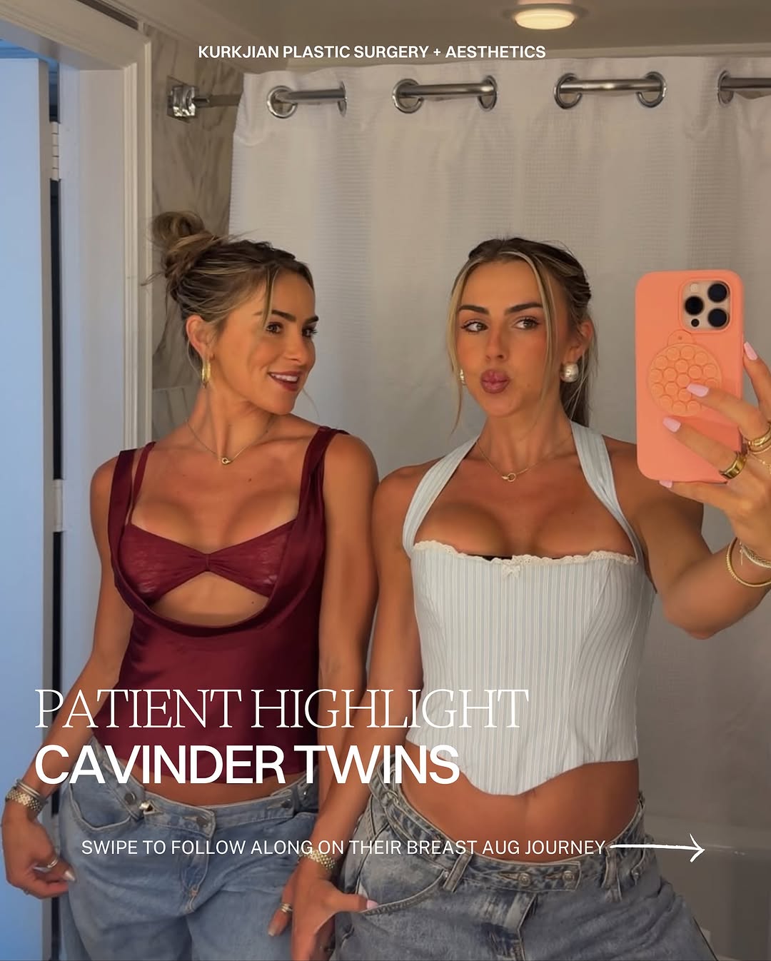 Instagram post by Dr. Jon Kurkjian: PATIENT HIGHLIGHT ✨ | The Cavinder Twins @cavindertwins From consultation to post-op—swipe through the real, unfiltered breast augmentation …