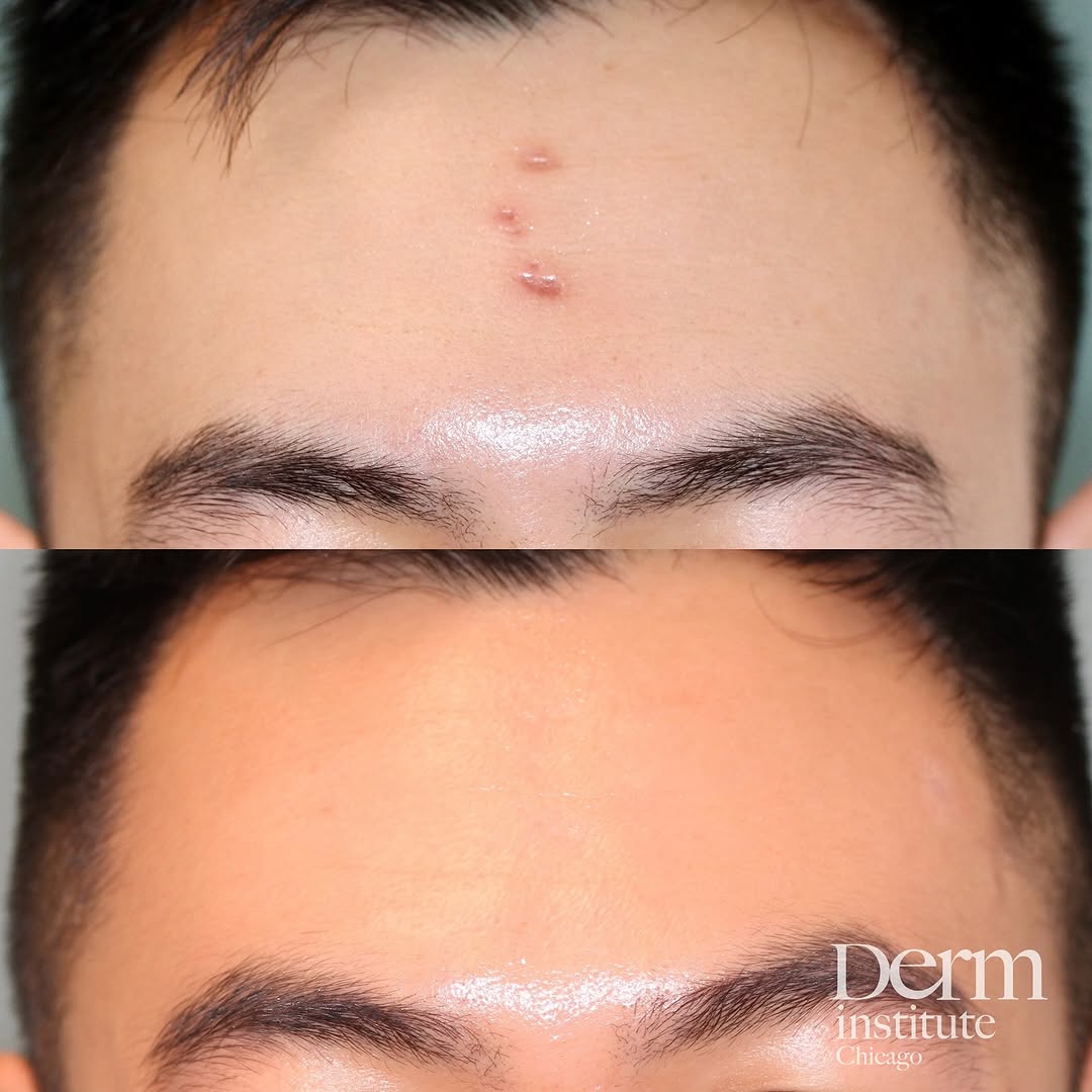 Instagram post by Dr. Jordan C. Carqueville: Reflecting on some of the cases that meant a lot to me this year. This patient was a victim of a hate crime in Chicago, attacked on the stre…