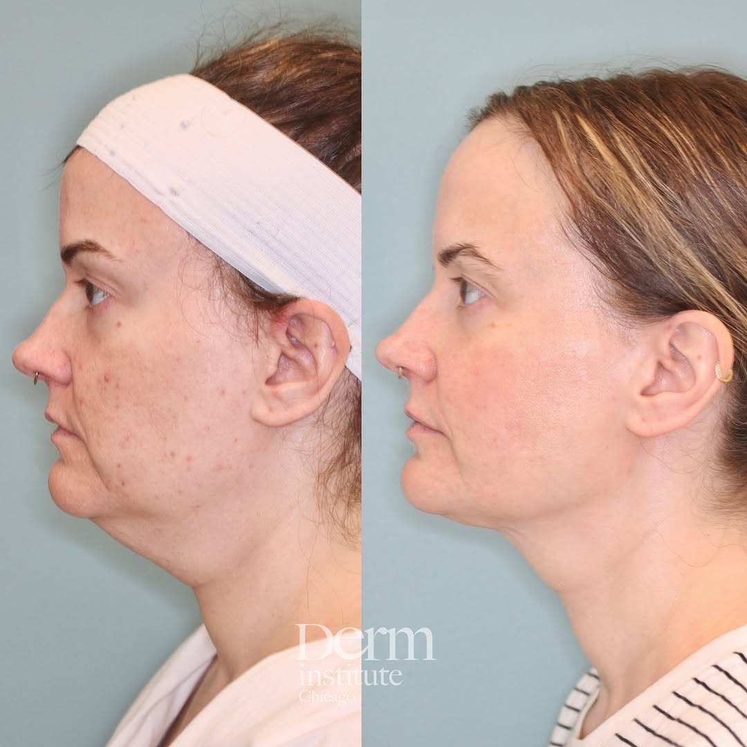 Instagram post by Dr. Jordan C. Carqueville: If you don’t know me, or are new to my page, welcome! I’m a cosmetic dermatologist, triple board-certified in Dermatology, Mohs Micrographic…