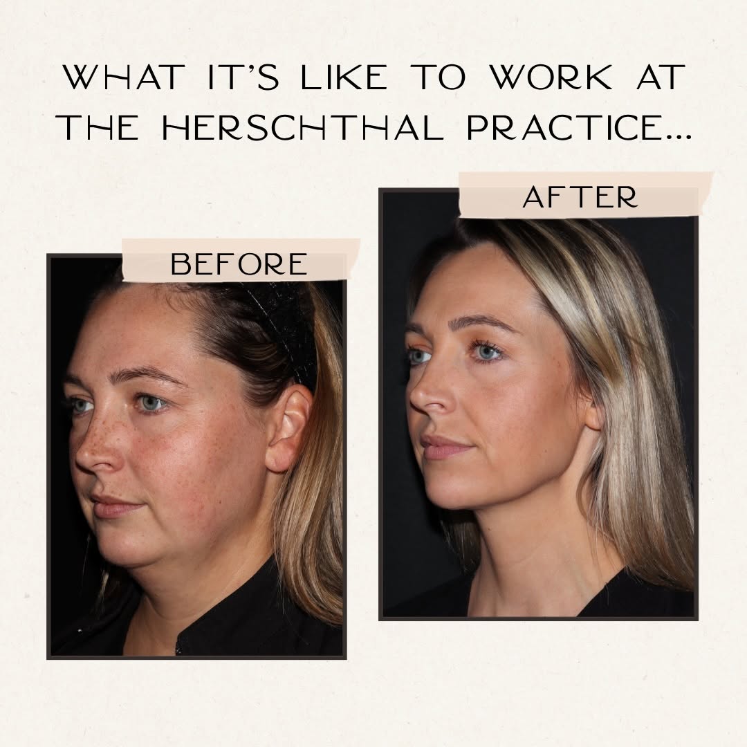 Instagram post by Dr. Jordana Herschthal: The best version of yourself. When new patients worry if they are going to look weird, I encourage them to look at our team. Natural and nev…