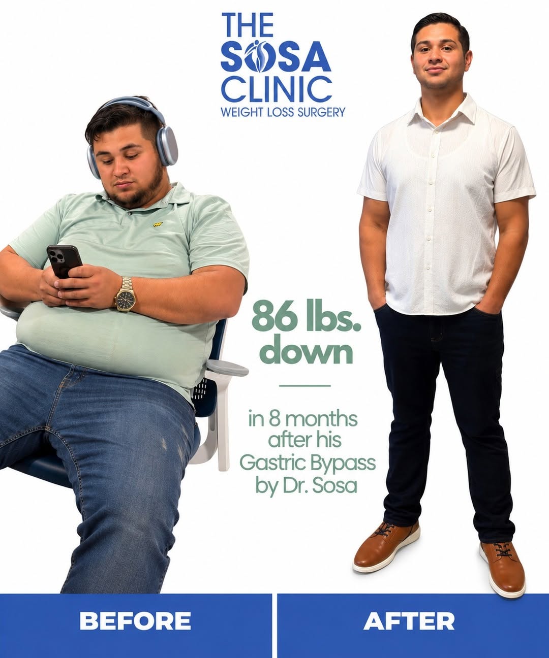 Instagram post by Dr. Jorge Sosa: 86 lbs. down in just 8 months. 💙 Williams chose a Gastric Bypass with Dr. Sosa and the difference speaks for itself. This is what can happe…