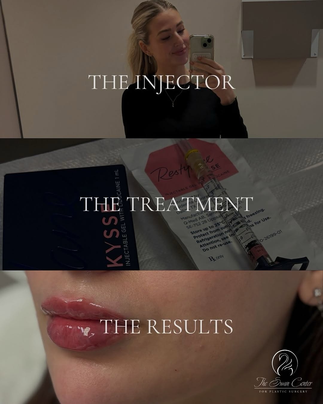 Instagram post by Dr. Joseph G. Bauer: The injector. The treatment. The results. 💋