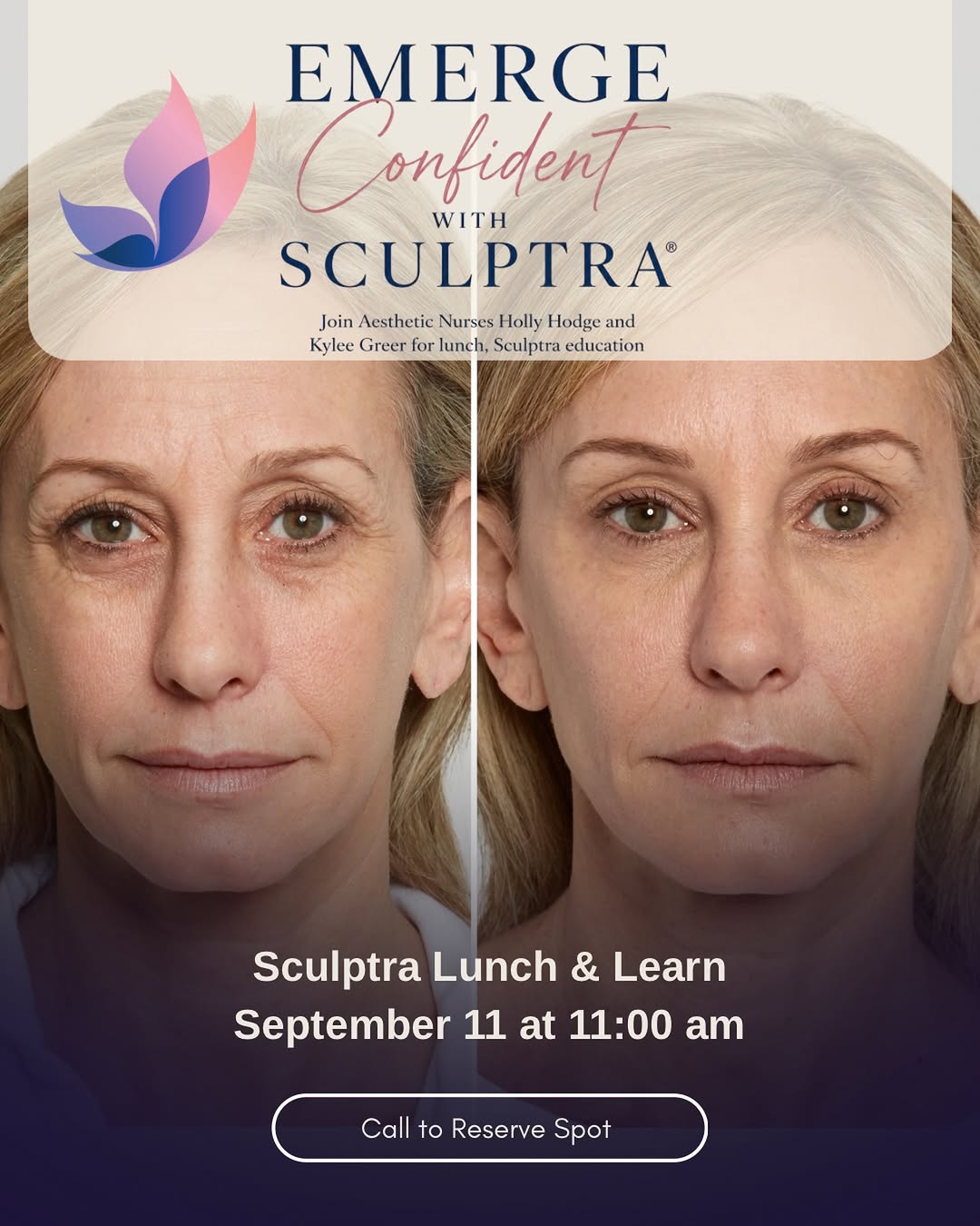 Instagram post by Dr. Joseph L. Hill Jr.: Curious about Sculptra? 🦋 Join Holly + Kylee one week from today for our Sculptra Lunch & Learn! Learn how Sculptra works, how it differs f…