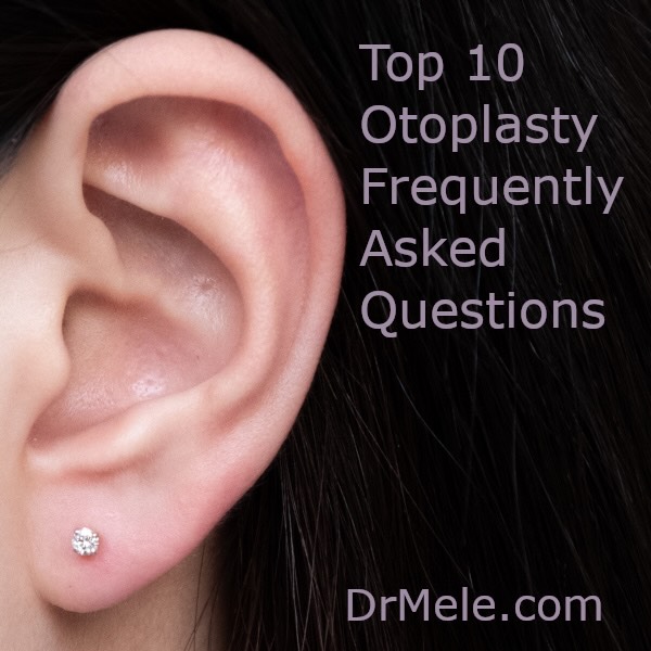 Instagram post by Dr. Joseph Mele: Otoplasty, commonly known as Ear Pinning or Ear Reshaping Surgery, is a cosmetic and reconstructive procedure designed to reposition, reshap…