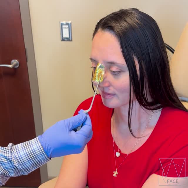 Instagram post by Dr. Joseph Shvidler: "I'm so happy, I want to cry!" 🥹 . #westcoastface #seattlefacial #rhinoplasty #rhinoplastybeforeandafter #rhinoplastyreveal . . Dr. Joseph …