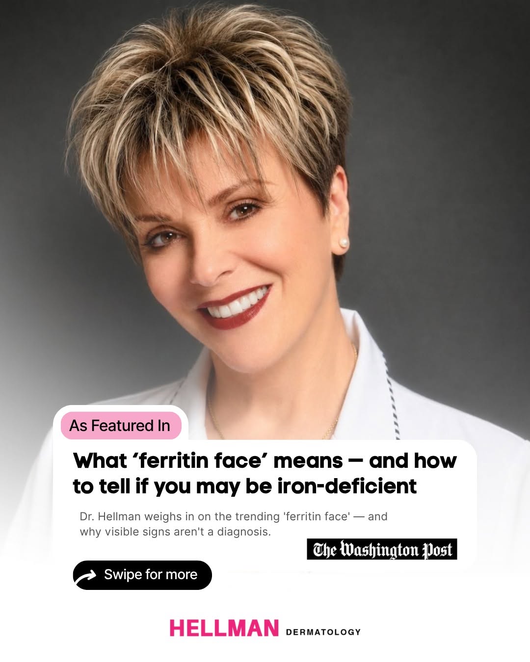 Instagram post by Dr. Judith Hellman: I was recently asked by The Washington Post to weigh in on "ferritin face", the trending idea that a tired, washed-out look means you're low…