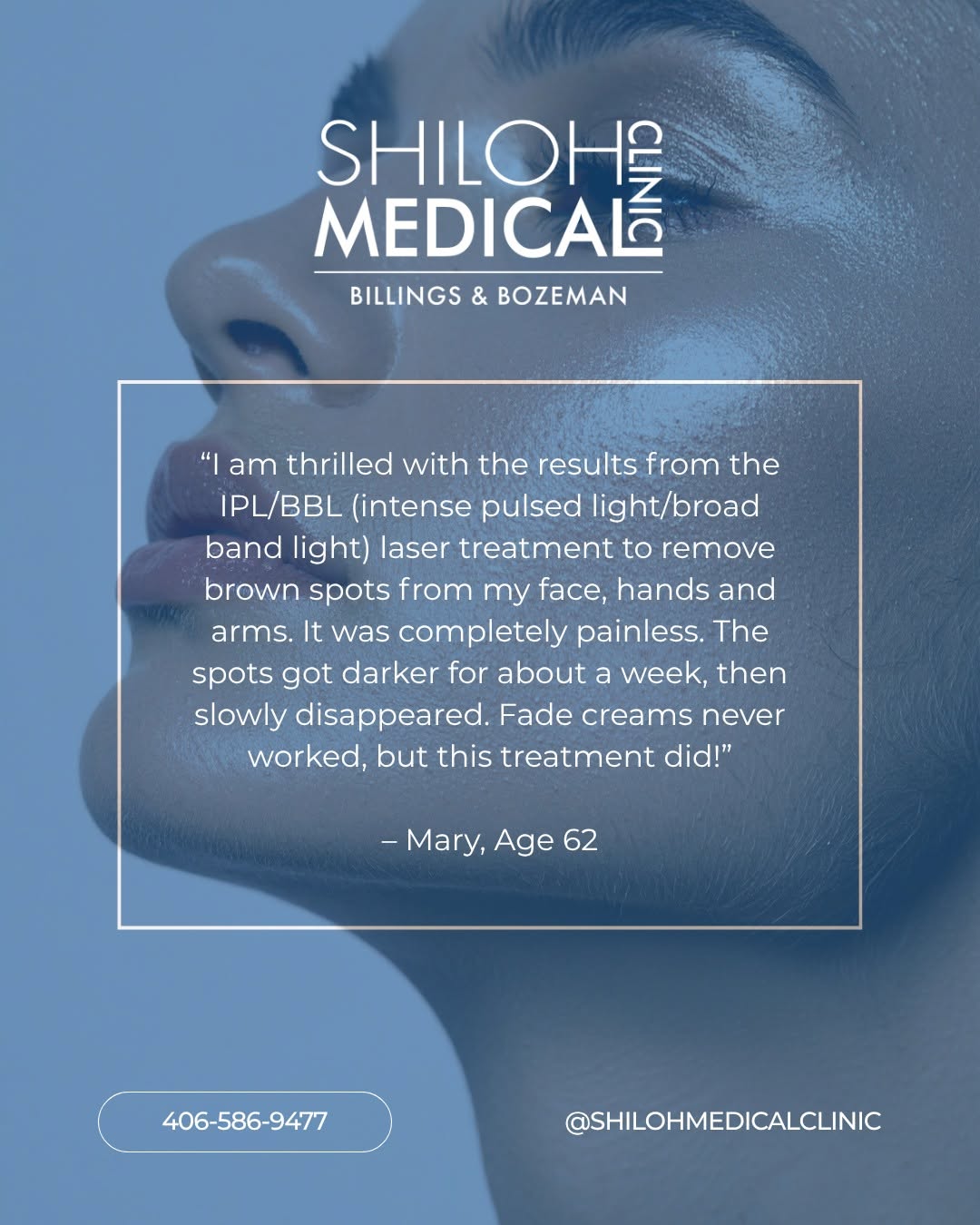 Instagram post by Dr. Julie Reil: Real patients. Real results. 💙 Brown spots and sun damage can be stubborn, especially when creams and at-home products aren't giving you th…