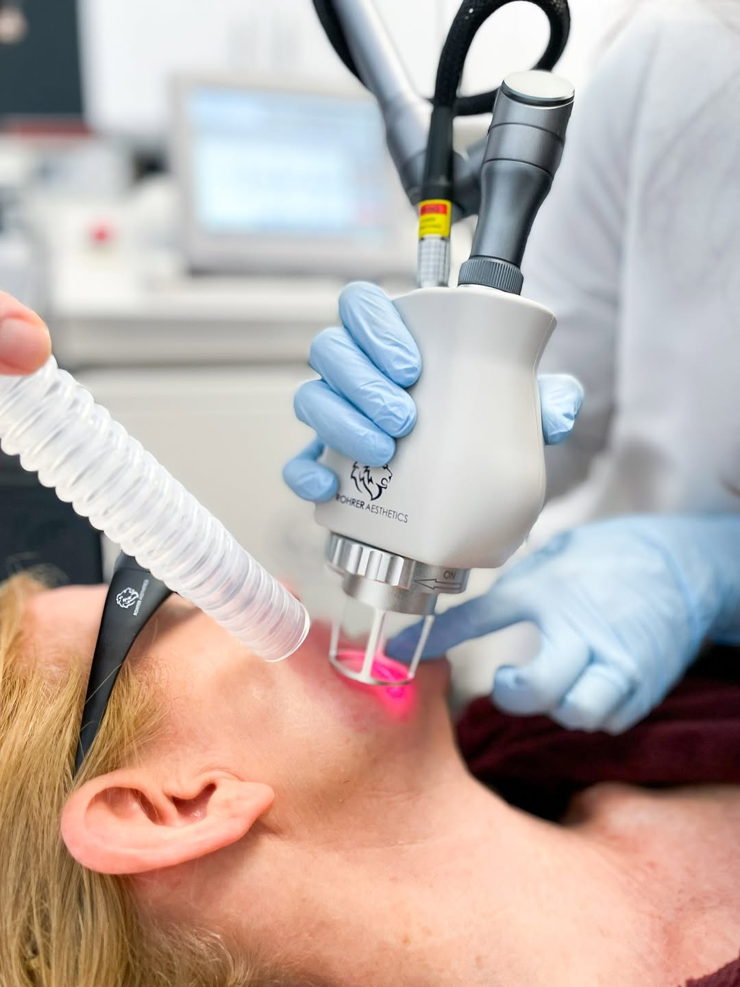 Instagram post by Dr. Kally Papantoniou: Fraxel or CO2? Fraxel may be a better fit for gradual improvement in sun damage, pigmentation, texture, fine lines and certain scars. CO2 pr…
