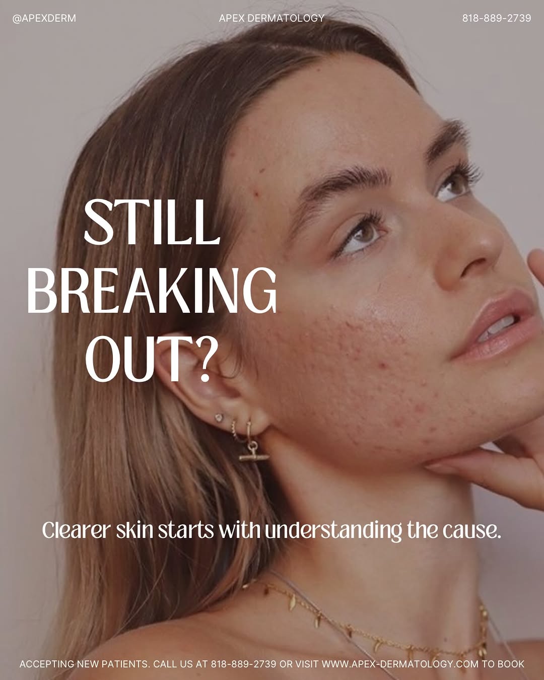 Instagram post by Dr. Karin Harp: Still breaking out even though you’ve tried product after product? 😩 Your acne may not be something you can simply “wash away.” Hormones, c…