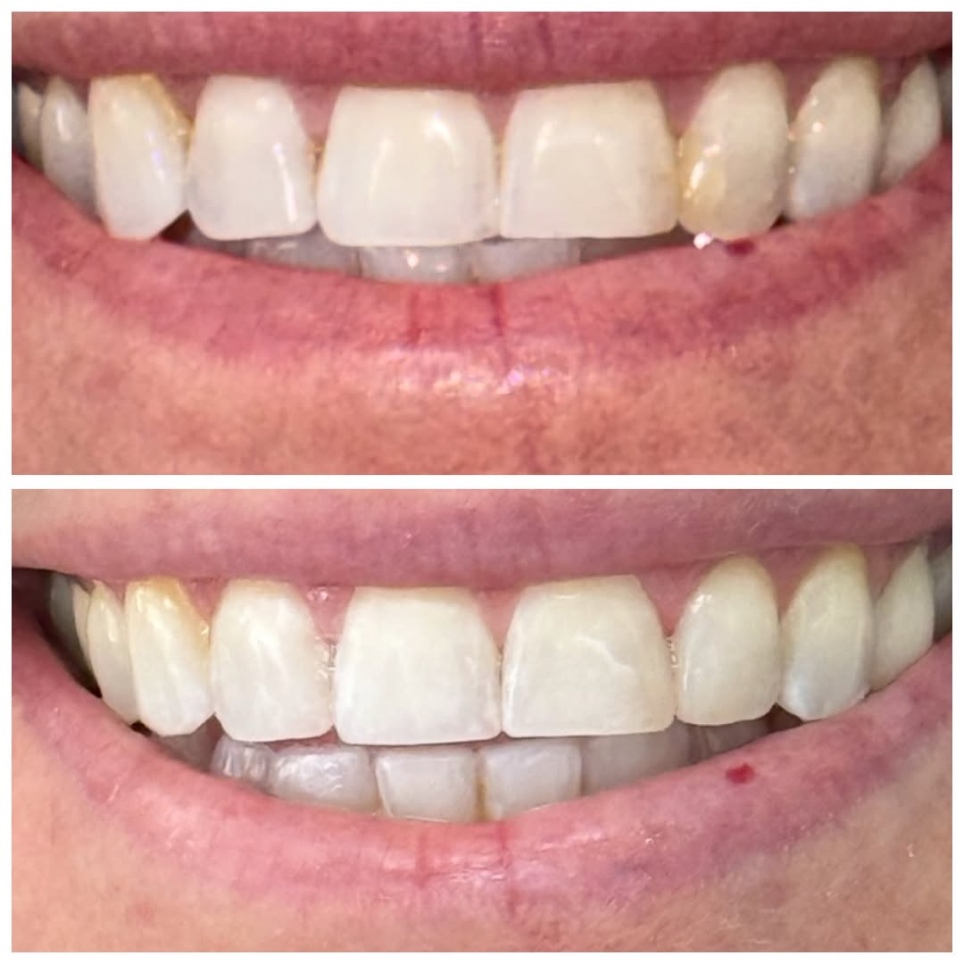 Instagram post by Dr. Kate Sahafi: The power of a Ā« micro-makeover. Ā» āØ