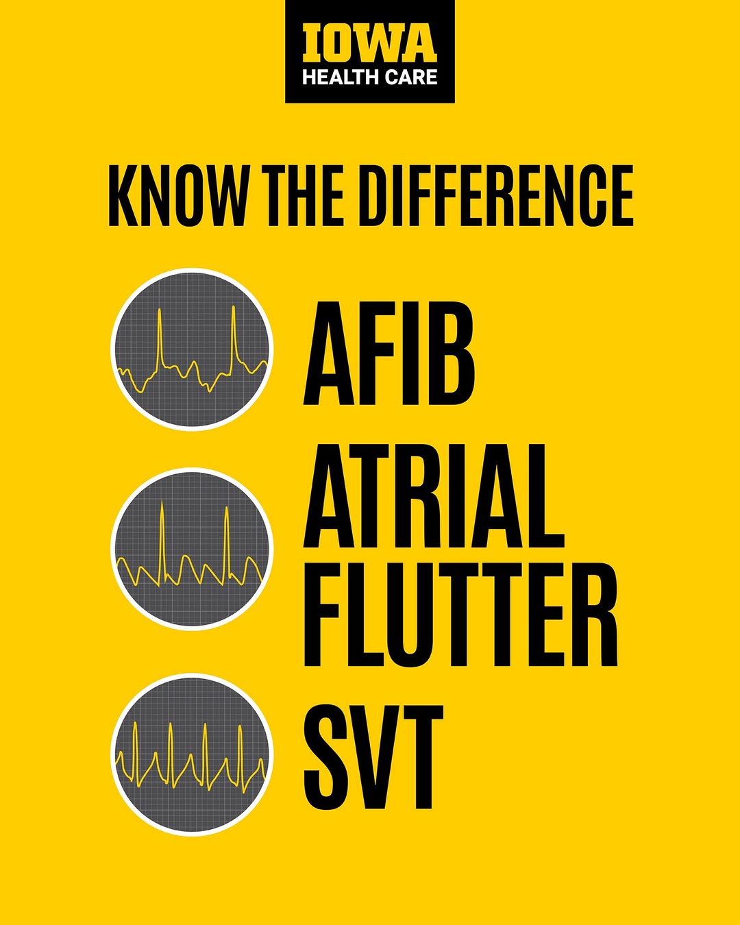 Instagram post by Dr. Keith D. Carter: AFib, atrial flutter, or STV? Swipe to learn the differences between these heart rhythms. ➡️