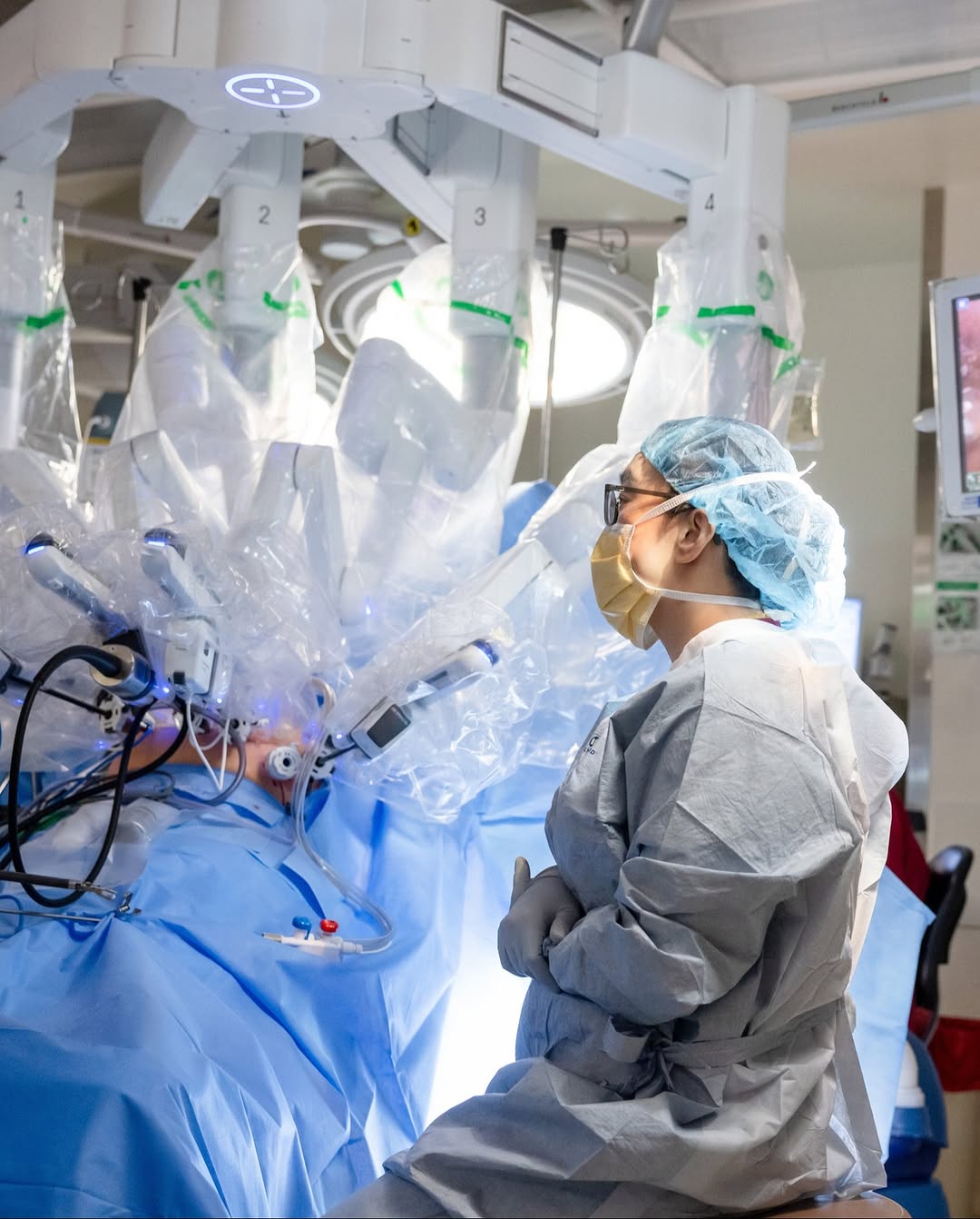 An operating room scene showing a surgeon sitting beside a patient on the operating table, who is draped in blue. Multiple robotic arms, numbered one through four, of a DaVinci surgical system are dra