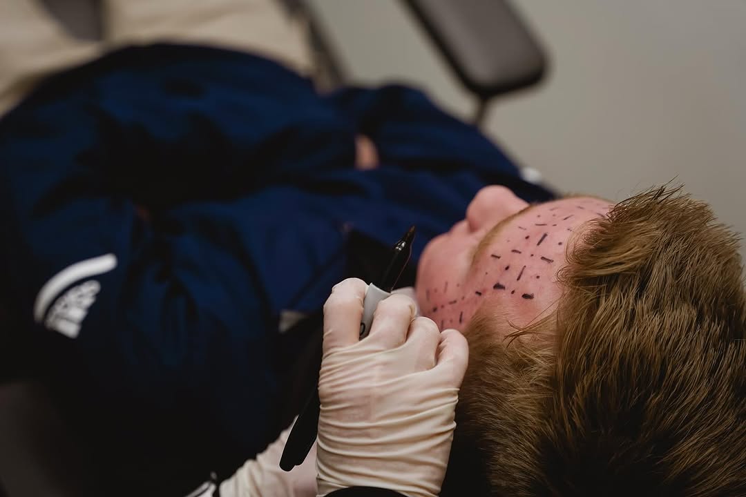 Instagram post by Dr. Kelly Hubbard: Our newest addition, the Accure Acne Laser was thoughtfully designed by dermatologists, experts in skin, to help vanquish your acne. Visit a…