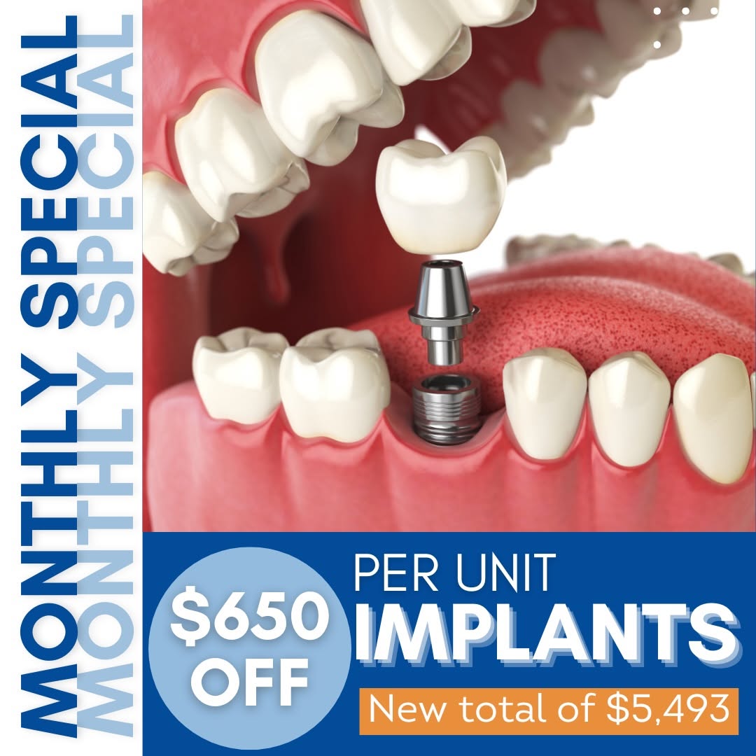 Instagram post by Dr. Ken Cirka, D: Missing teeth? We’ve got you covered. 🦷 This month only, enjoy $650 OFF dental implants — completed start to finish in-house for your conve…