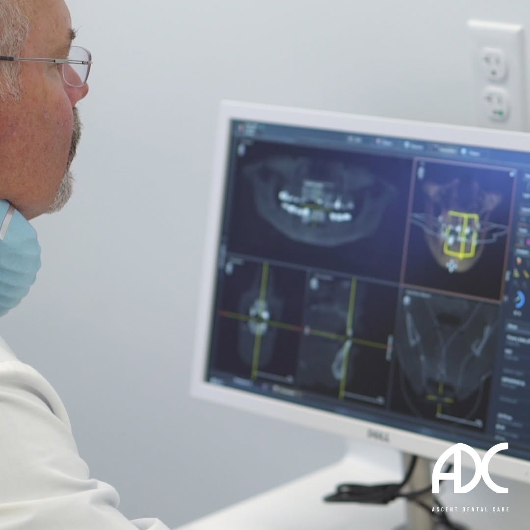 Instagram post by Dr. Kevin Coughlin, D: Preparing for oral surgery? It doesn't have to be daunting - our experienced team is here to guide you and provide the answers you need for …