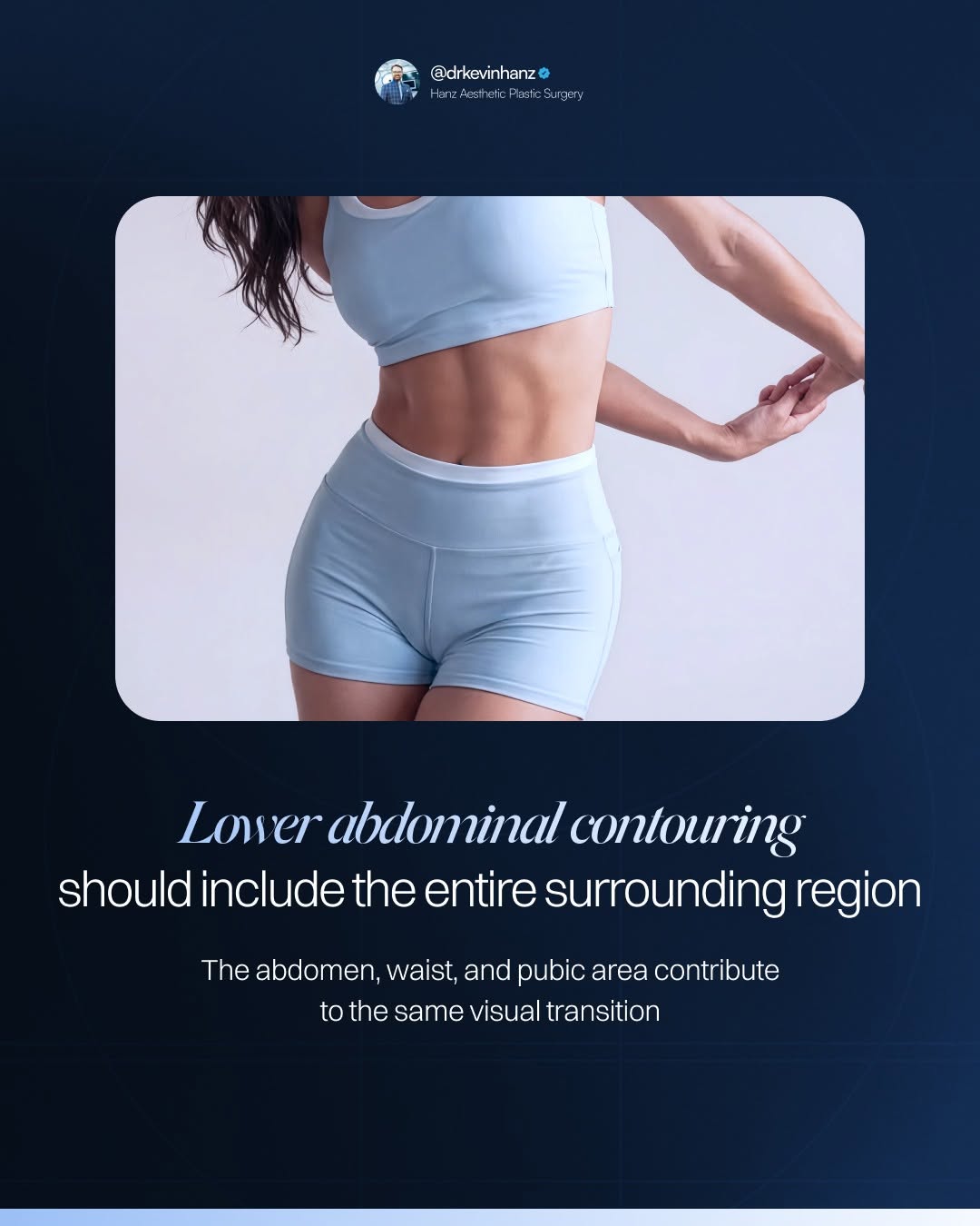 Instagram post by Dr. Kevin R. Hanz: After major weight loss, I evaluate much more than the central abdomen when planning body contouring. The lower abdominal tissues, waist, pu…