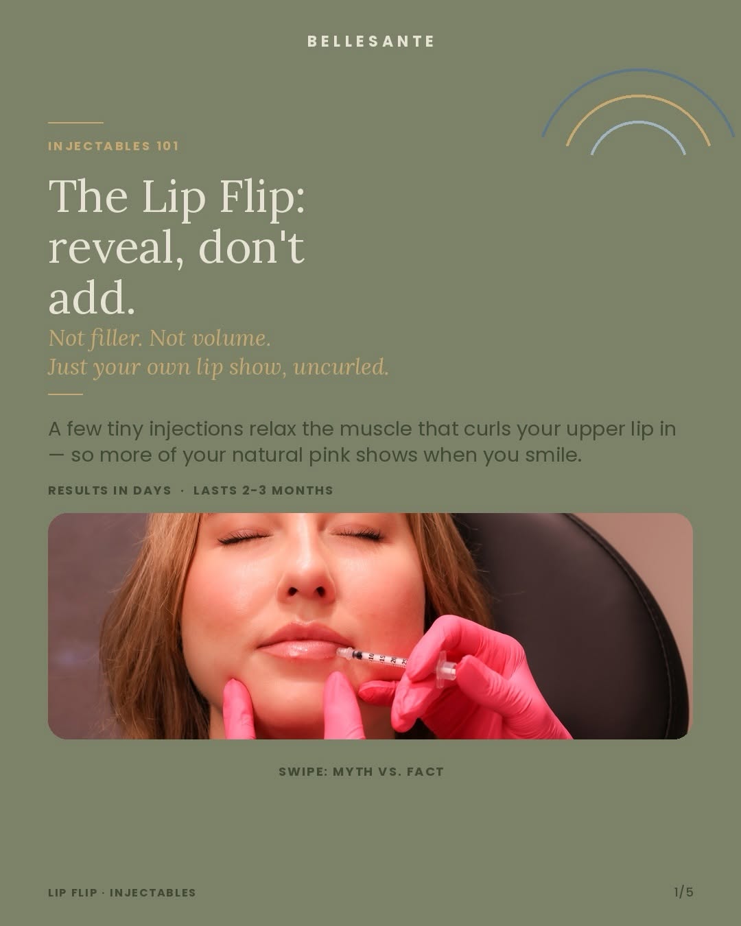 Instagram post by Dr. Kristine Romine: Isn’t a Lip Flip just... filler? 👀 Nope — and it’s one of the most misunderstood treatments we offer. A Lip Flip uses a few tiny drops of a…