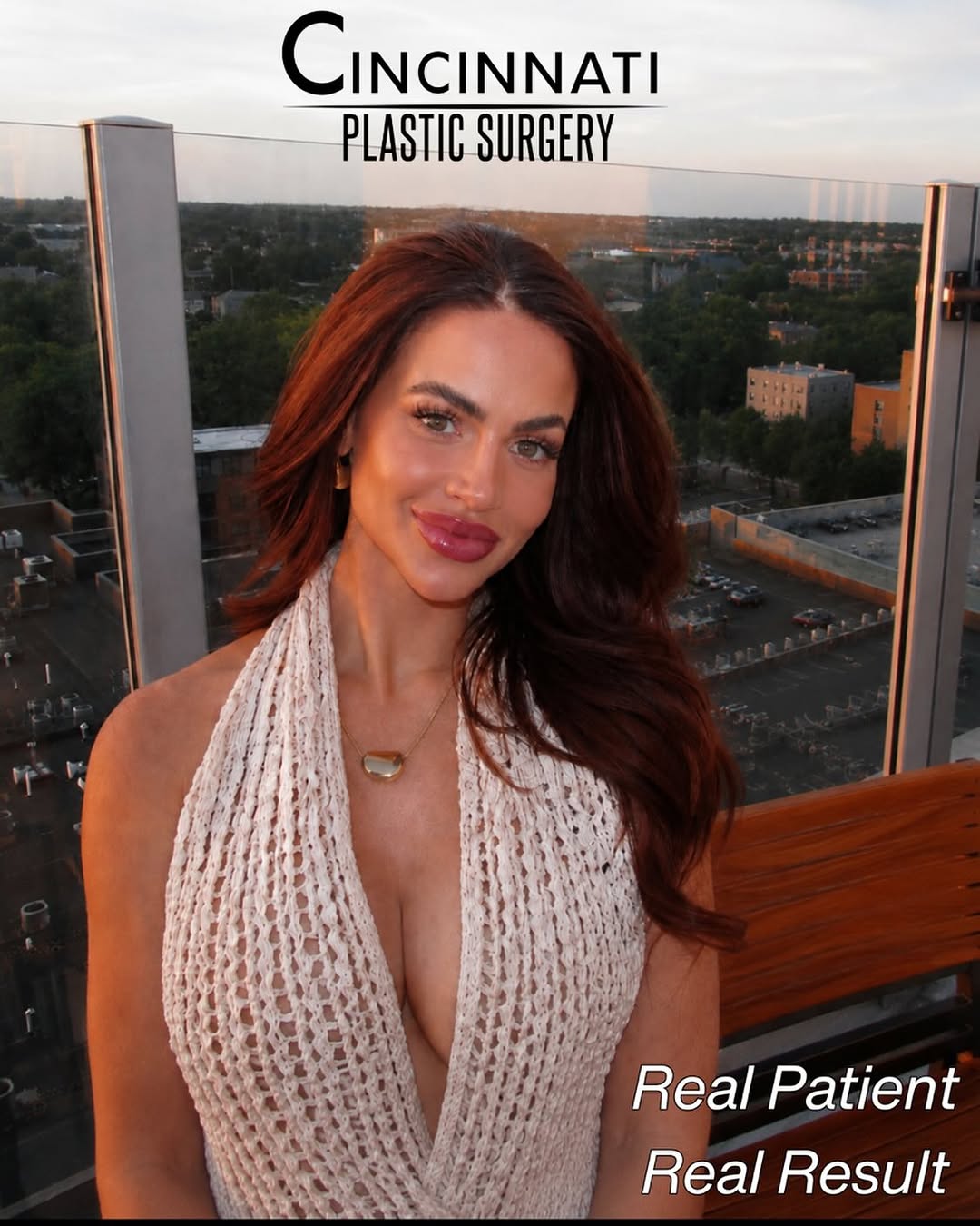 Instagram post by Dr. Kurtis Martin: Real Patient, Real Result We love it when our patients share their results! This gorgeous patient has been seeing Nurse Kimber for regular m…