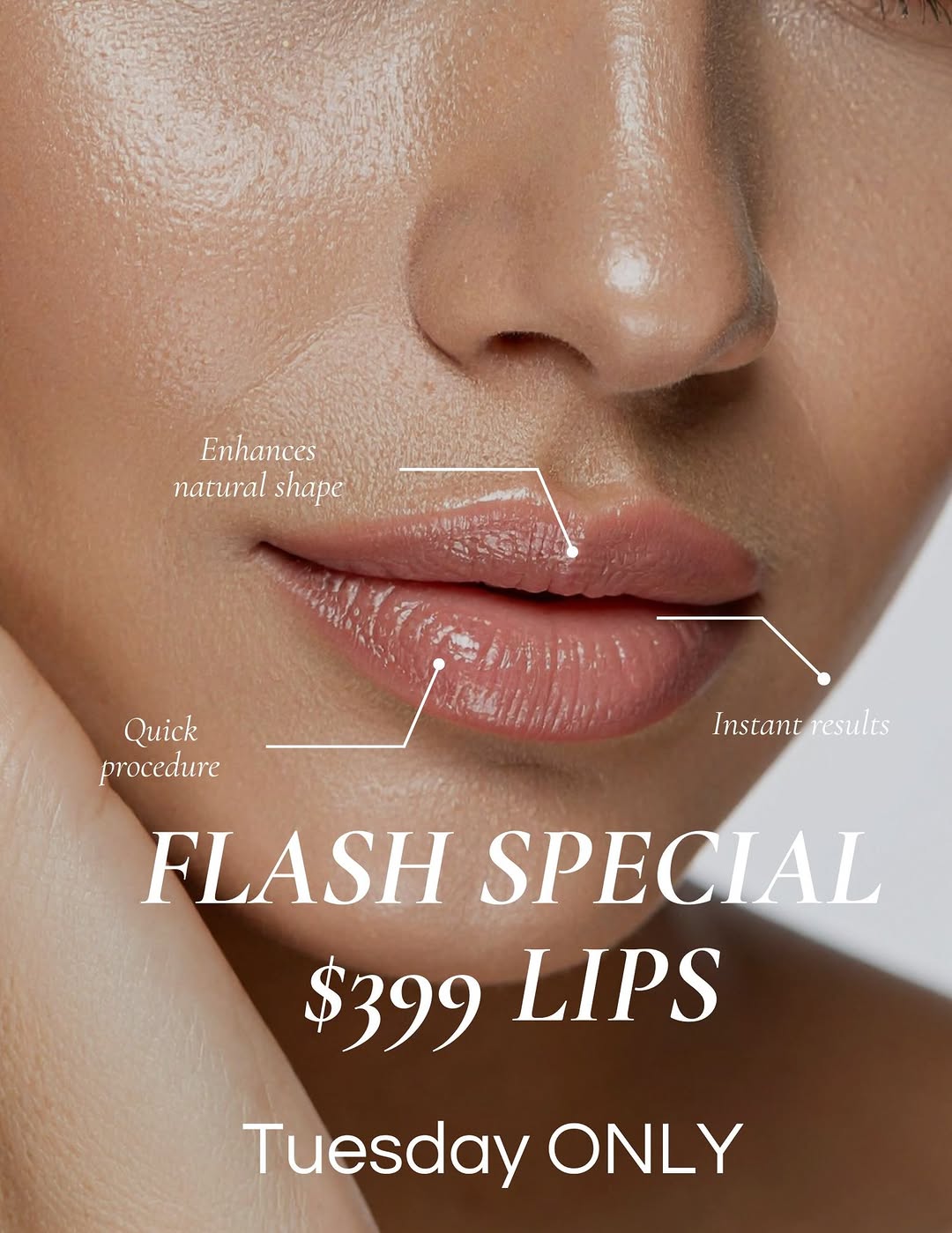 Instagram post by Dr. Kurtis Martin: $399 Lips, Today ONLY Tuesday August 25th ONLY, get a syringe of lip filler for just $399! This is our absolute best pricing ever! Revanesse…