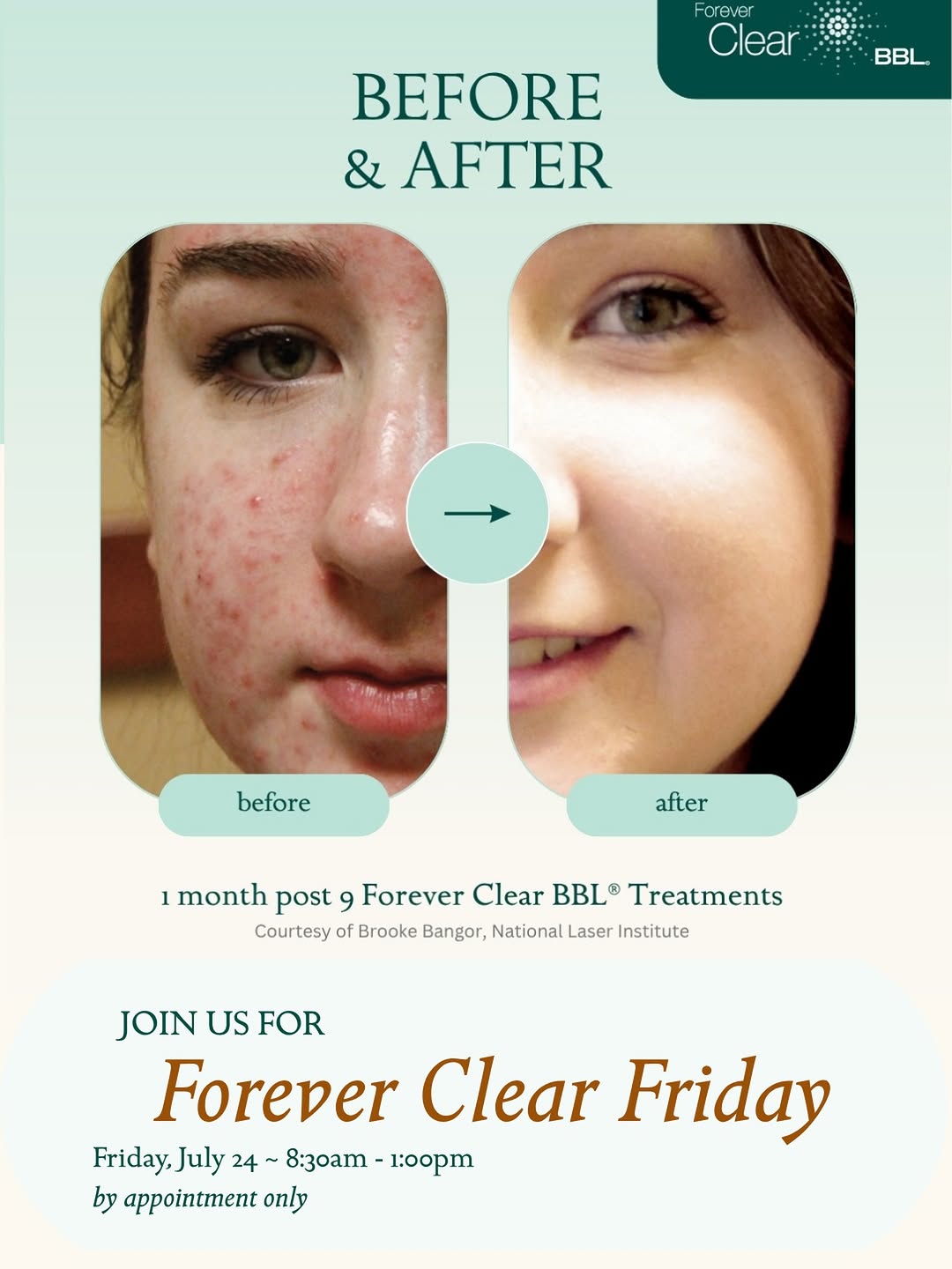Instagram post by Dr. L. Chris DeRosier: We’re ONE week away from our Forever Clear Friday Event on July 24 from 8:30 AM–1:00 PM 🤗 If clearer skin has been on your mind, now’s the …
