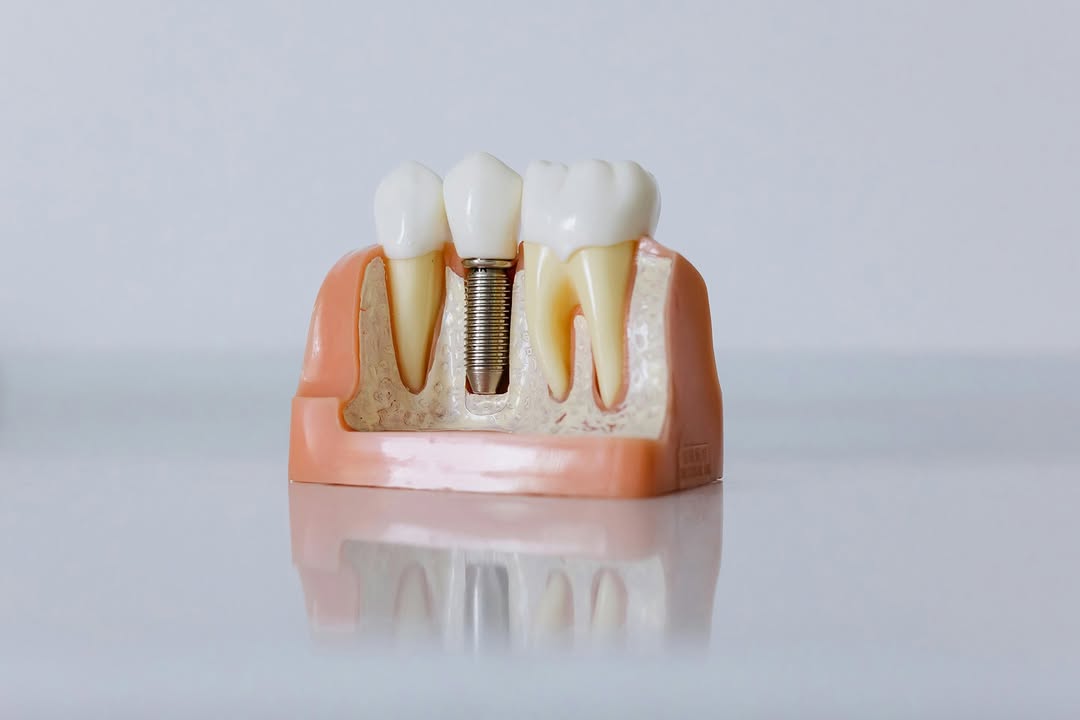 Instagram post by Dr. Laura Torrado: At Dental Wellness Airway: Laura Torrado DDS, FAGD, we believe every patient deserves personalized attention and genuine care. Dental wellne…