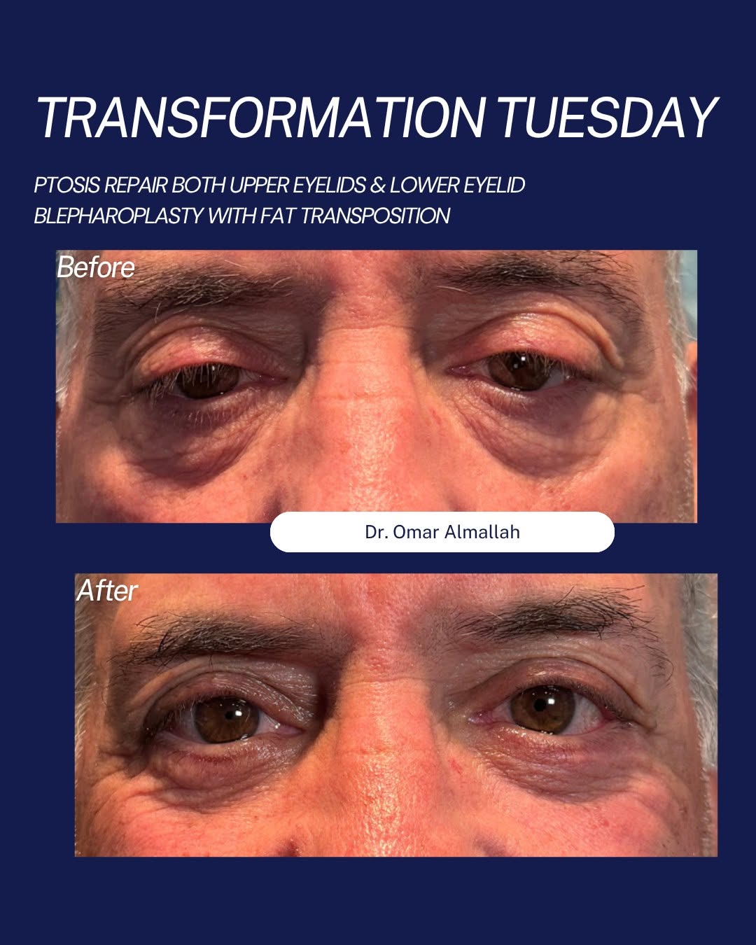 Instagram post by Dr. Lauren D. Mileo: ✨ Transformation Tuesday ✨ Restoring a brighter, more youthful appearance—while maintaining natural-looking results. This week, we're highli…