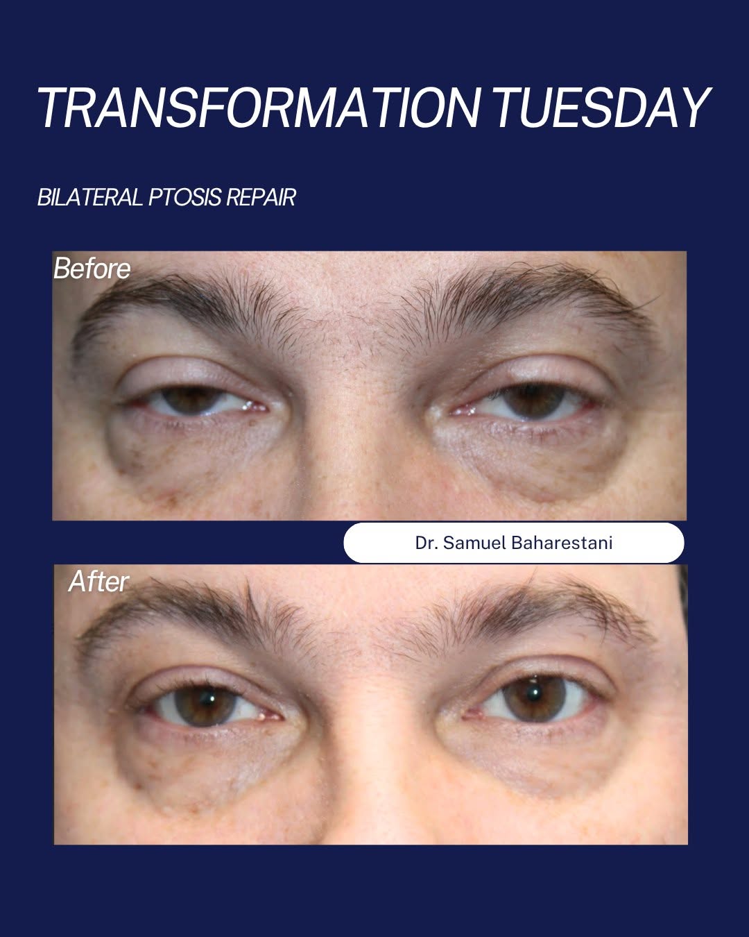 Instagram post by Dr. Lauren D. Mileo: ✨ Transformation Tuesday ✨ Sometimes the most meaningful transformations are the ones that help patients both see and feel better. This week…