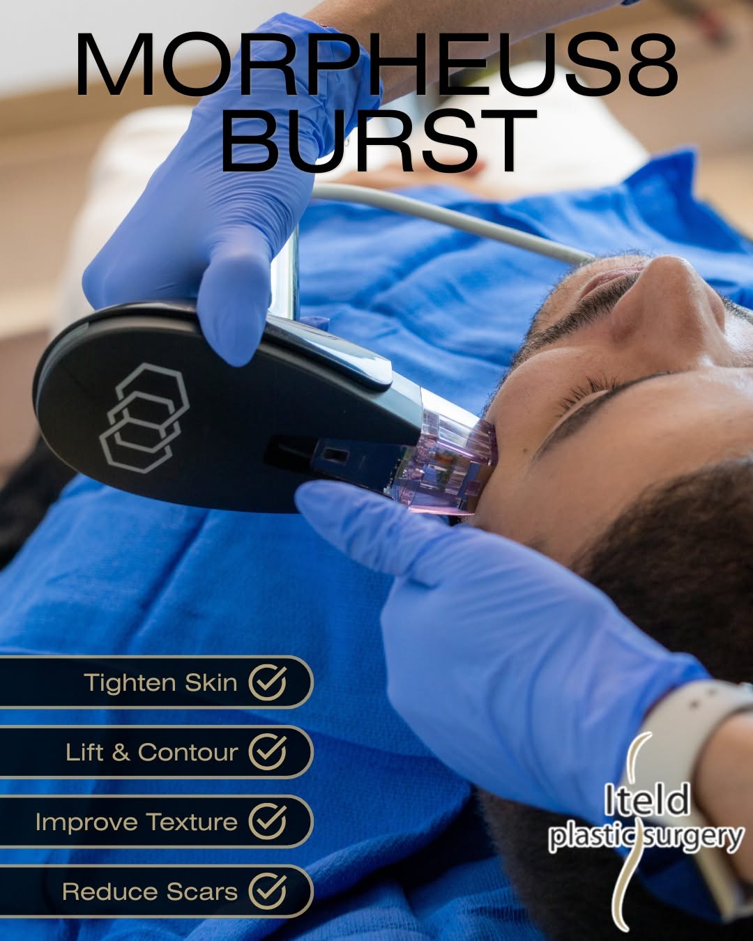 Instagram post by Dr. Lawrence Iteld: Go deeper than traditional microneedling. #Morpheus8Burst lifts and firms the lower face and jawline, improving skin laxity for smoother, ti…