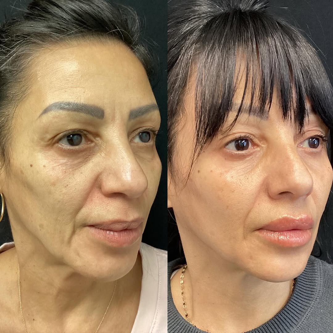 Instagram post by Dr. Leila S. Grayson: Do you want to age backwards? We can help • Whatever your preference- invasive/ non-invasive. Injectable/non-injectable. We have options for…