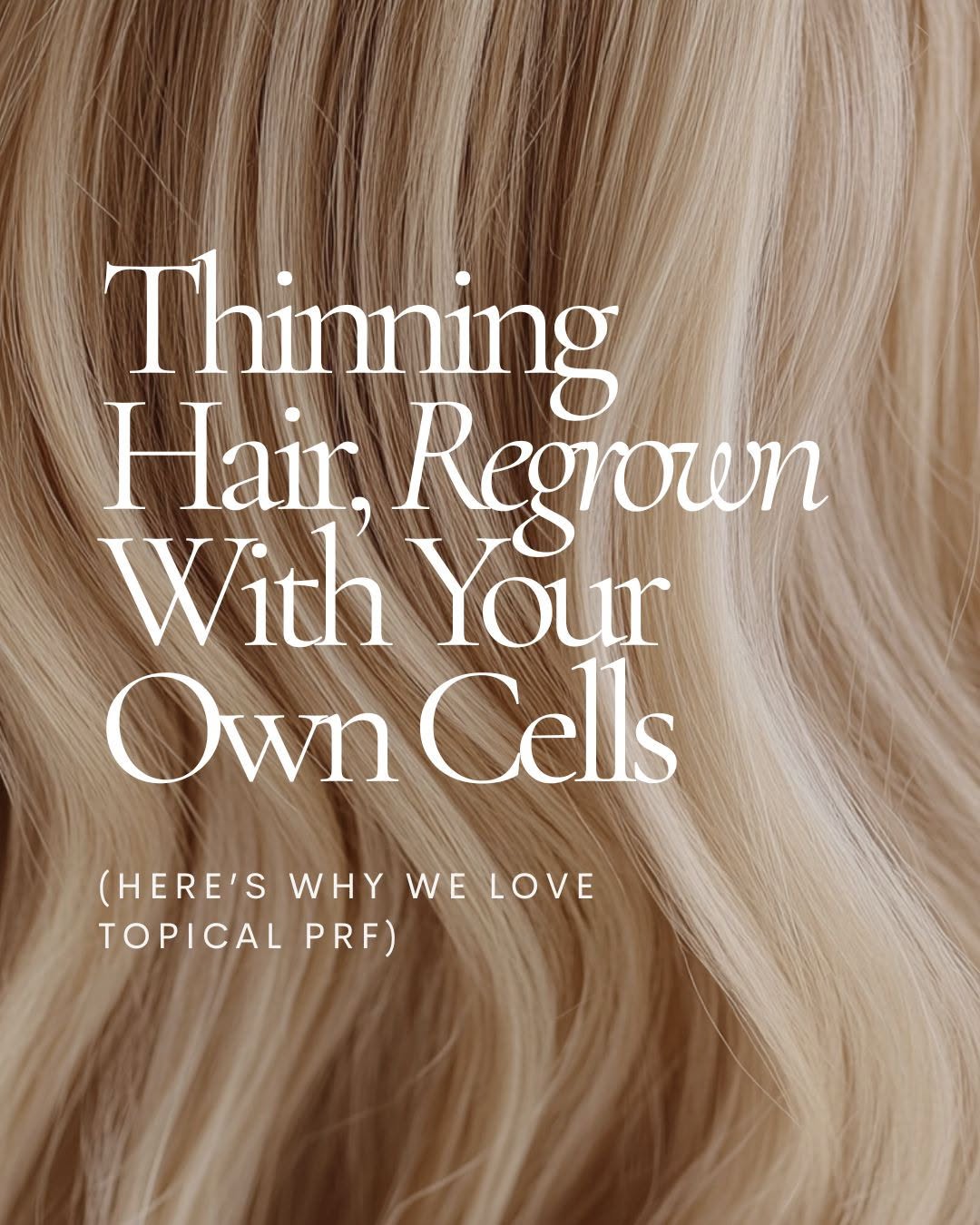 Instagram post by Dr. Lily Talakoub: Topical PRF is the perfect add-on when you want to support hair restoration in a more natural way. Applied after microneedling, it helps enh…