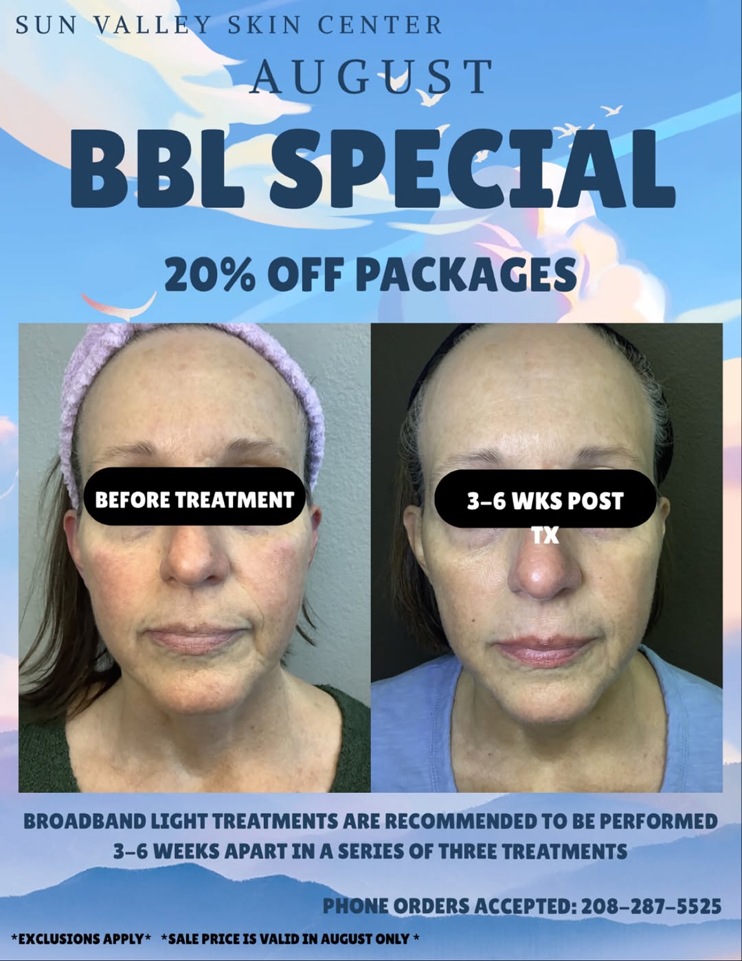 Instagram post by Dr. Lindie Borton: Our August BBL special is live all month long! 20% off packages of three, call today for more info! #svscboise #sunvalleyskincenter #dermato…