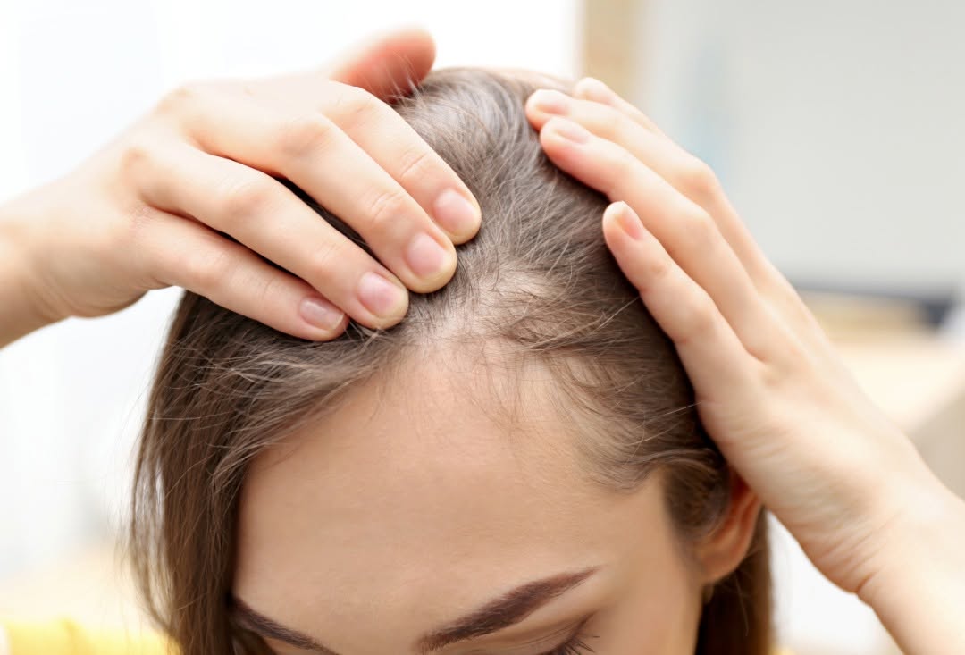 Instagram post by Dr. Lori Warren: Healthy hair starts at the scalp. If you've noticed increased shedding or thinning, now is the perfect time to explore non-surgical hair res…