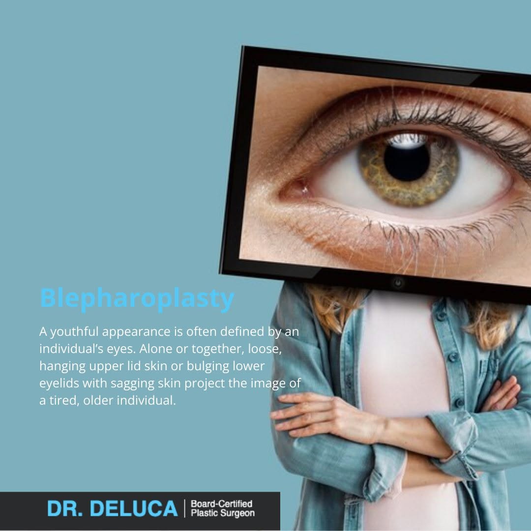Instagram post by Dr. Louis DeLuca: A youthful appearance is often defined by an individual's eyes. Alone or together, loose, hanging upper lid skin or bulging lower eyelids wi…