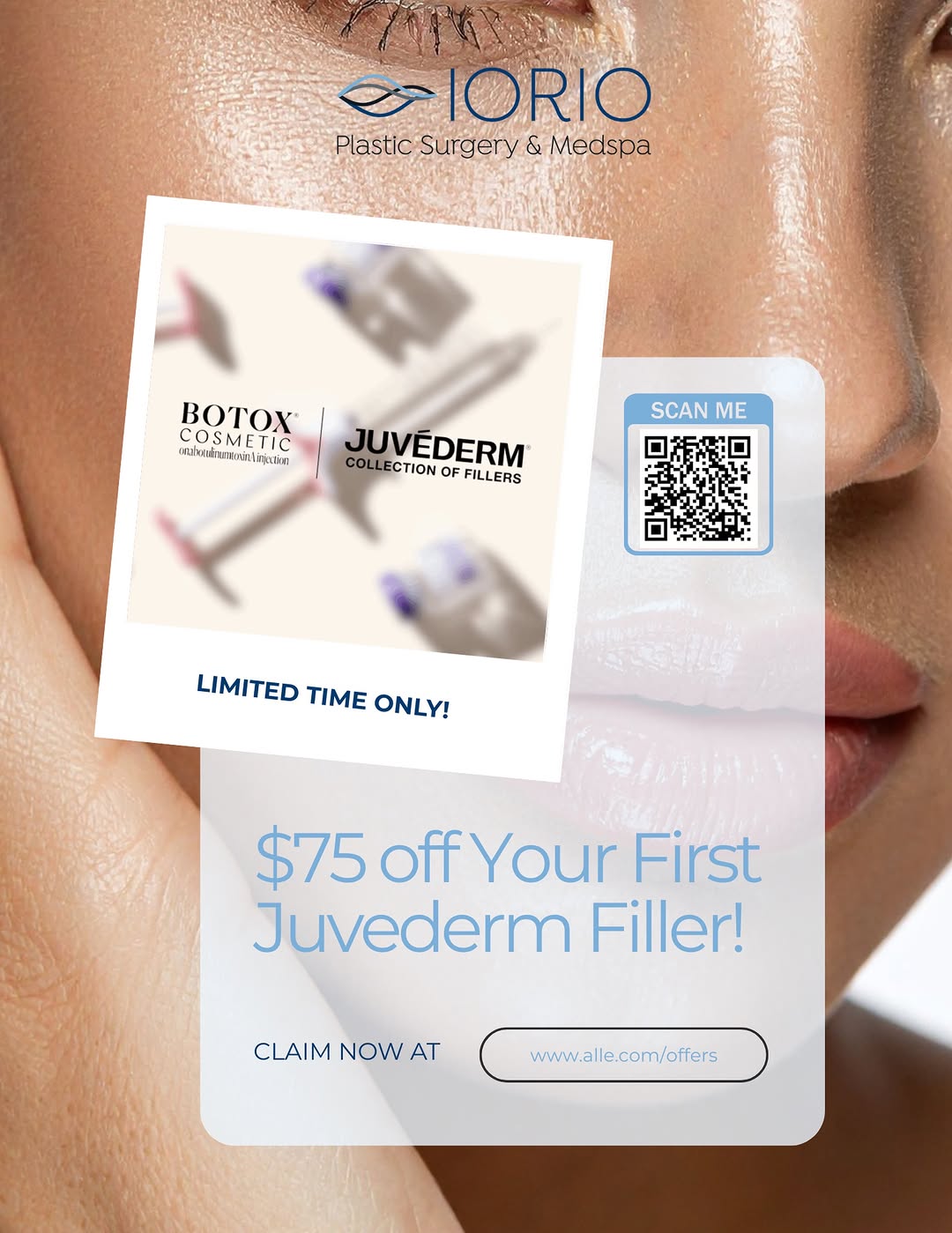 Instagram post by Dr. Louis M. Iorio: 💉 Limited-Time JUVÉDERM® Offer! 💉 Thinking about trying filler for the first time? Now is the perfect time! For a limited time, new JUVÉDE…