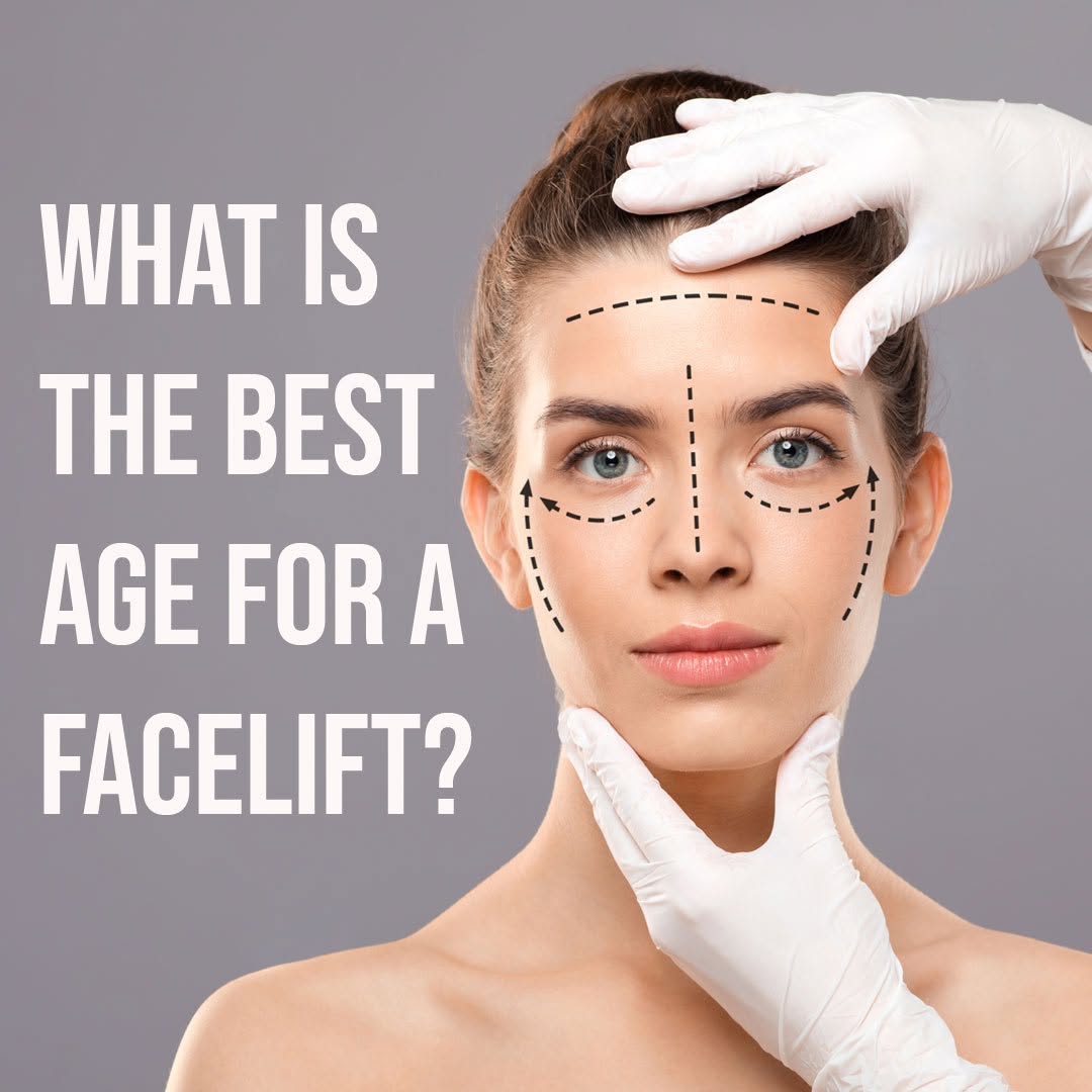 Instagram post by Dr. Louis W. Apostolakis: What Is the Best Age for a Facelift? A facelift allows you to look and feel younger, whether you’re in your 40s, 50s, or 60s. Learn when the…