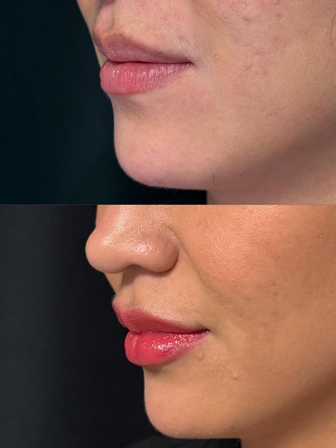 Instagram post by Dr. Lynn Chung: Small refinements, beautiful balance ✨ Enhancing natural features while keeping you looking like you. A little structure, a little hydration…