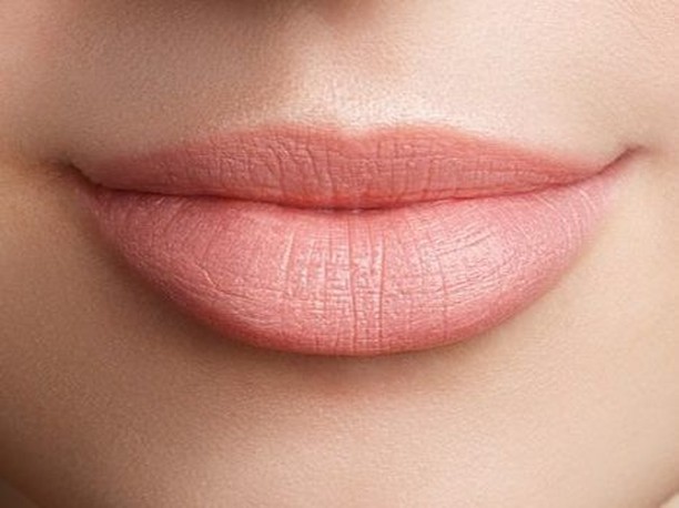 Instagram post by Dr. M. Sadi Erfani: Perma Lip Implant Special