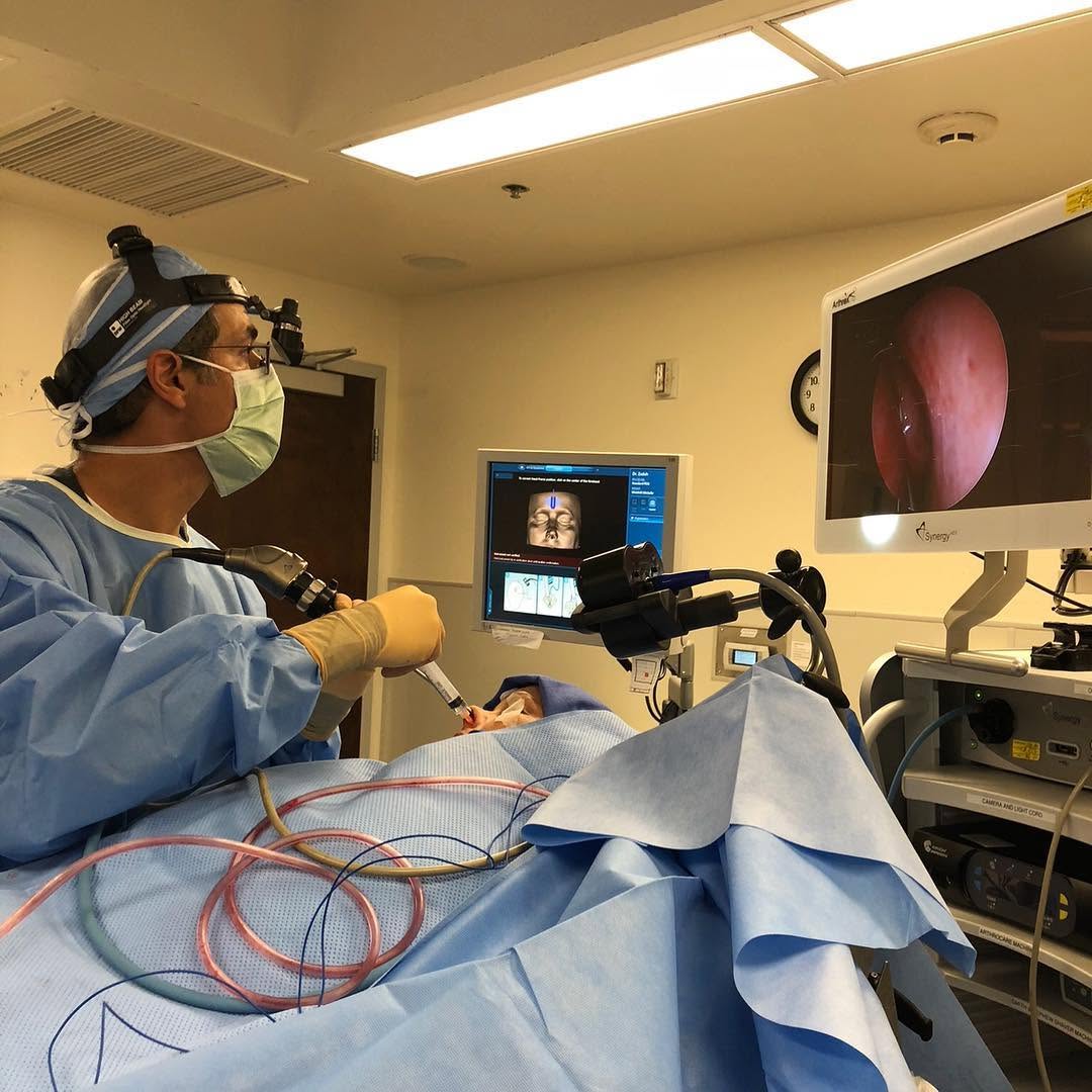 Instagram post by Dr. Mani H. Zadeh: Sinusitis patients with nasal polyps often have a loss of the sense of smell, also known as anosmia. This patient was suffering from chronic…