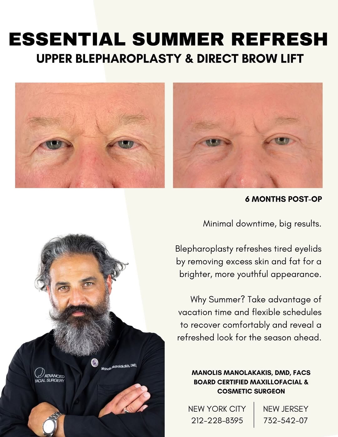Instagram post by Dr. Manolis Manolakakis, D: ✨ A refreshed, more youthful look with minimal downtime. ✨ Dr. Manolakakis, Board Certified Maxillofacial & Cosmetic Surgeon, recently perfo…