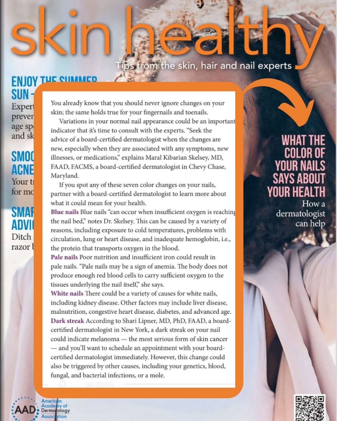 Instagram post by Dr. Maral Skelsey: I was featured in the recent issue of Skin Healthy magazine from American Academy of Dermatology (@AADskin1) discussing what the color of yo…