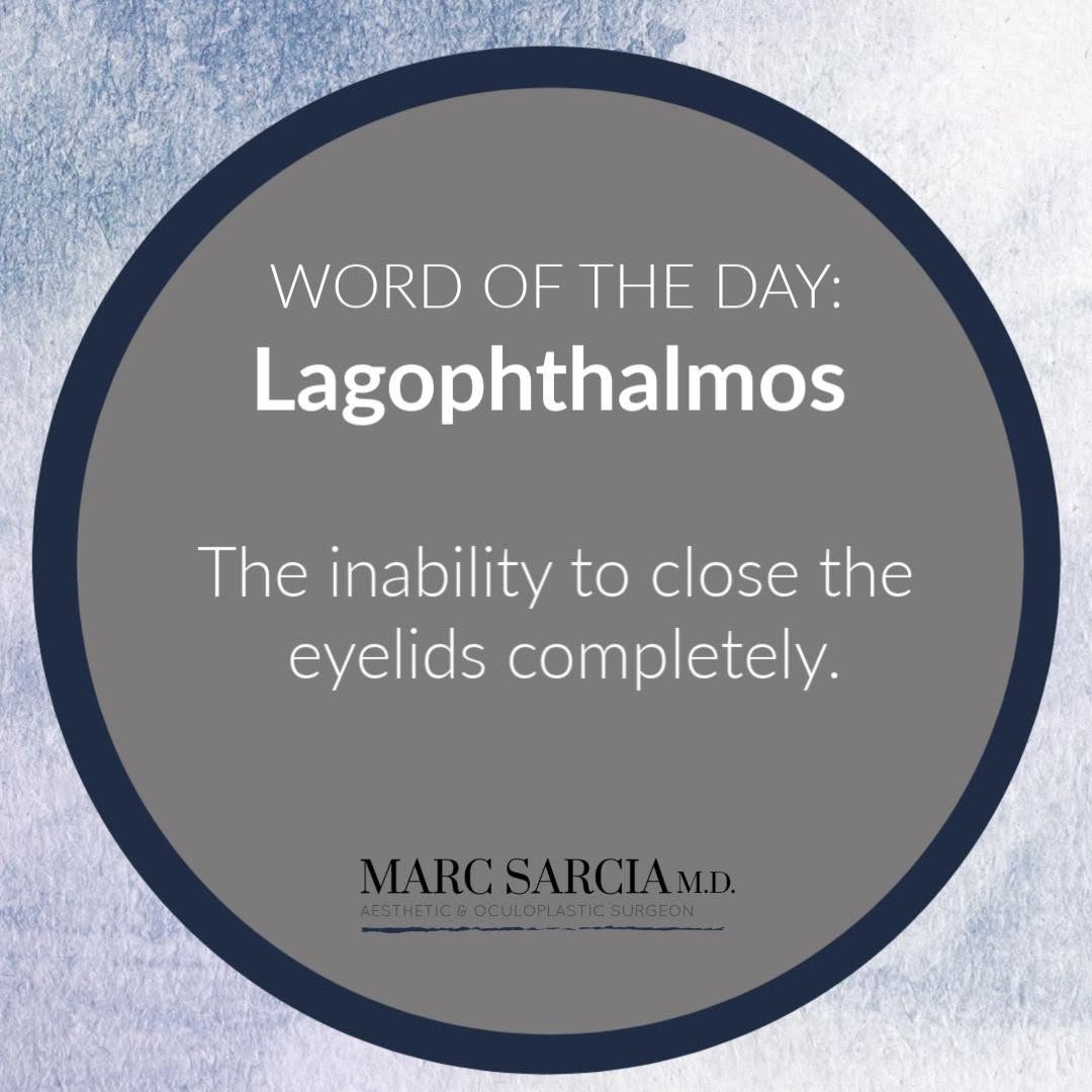 Instagram post by Dr. Marc A. Sarcia: The main cause for paralytic lagophthalmos is Bell's palsy but it may be secondary to trauma, infections, tumors, and many other conditions.…