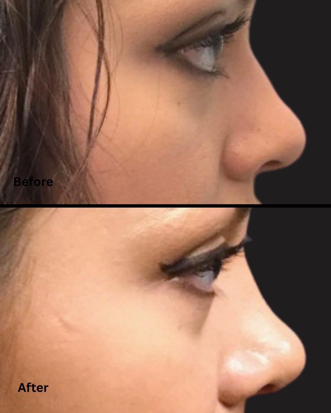 Instagram post by Dr. Marc Klein: Small adjustments can create major facial harmony. Call or text us to book your consultation today!