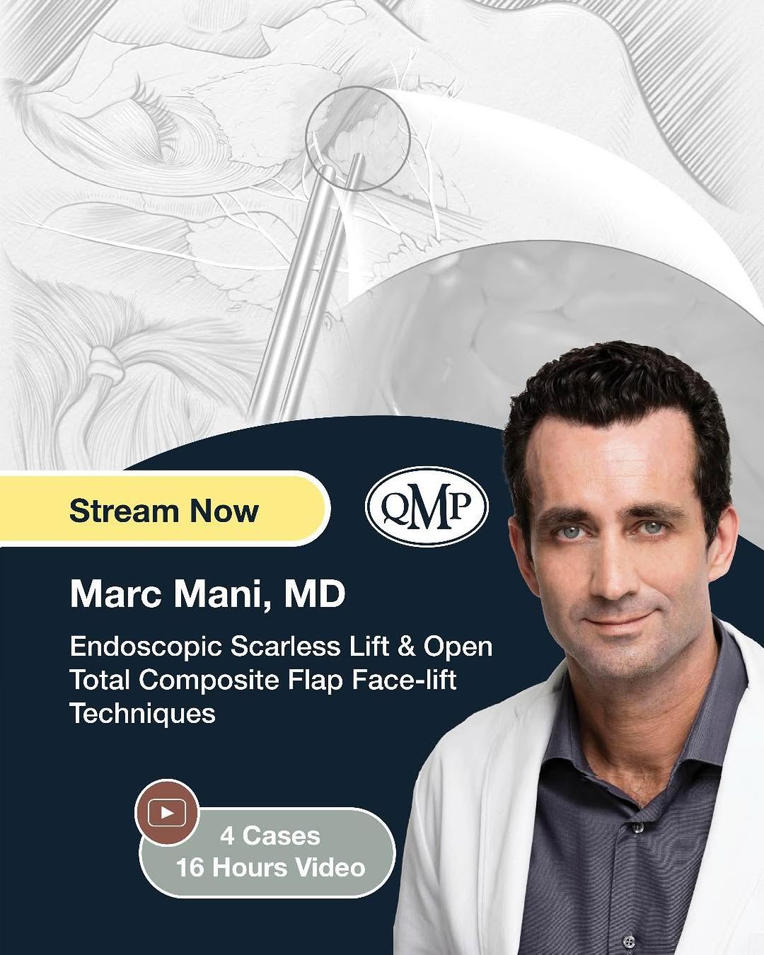 Instagram post by Dr. Marc Mani: Now Available! Endoscopic Scarless Lift and Open Total Composite Flap Face-lift Techniques by Marc Mani, MD Explore the endoscopic face-lift…