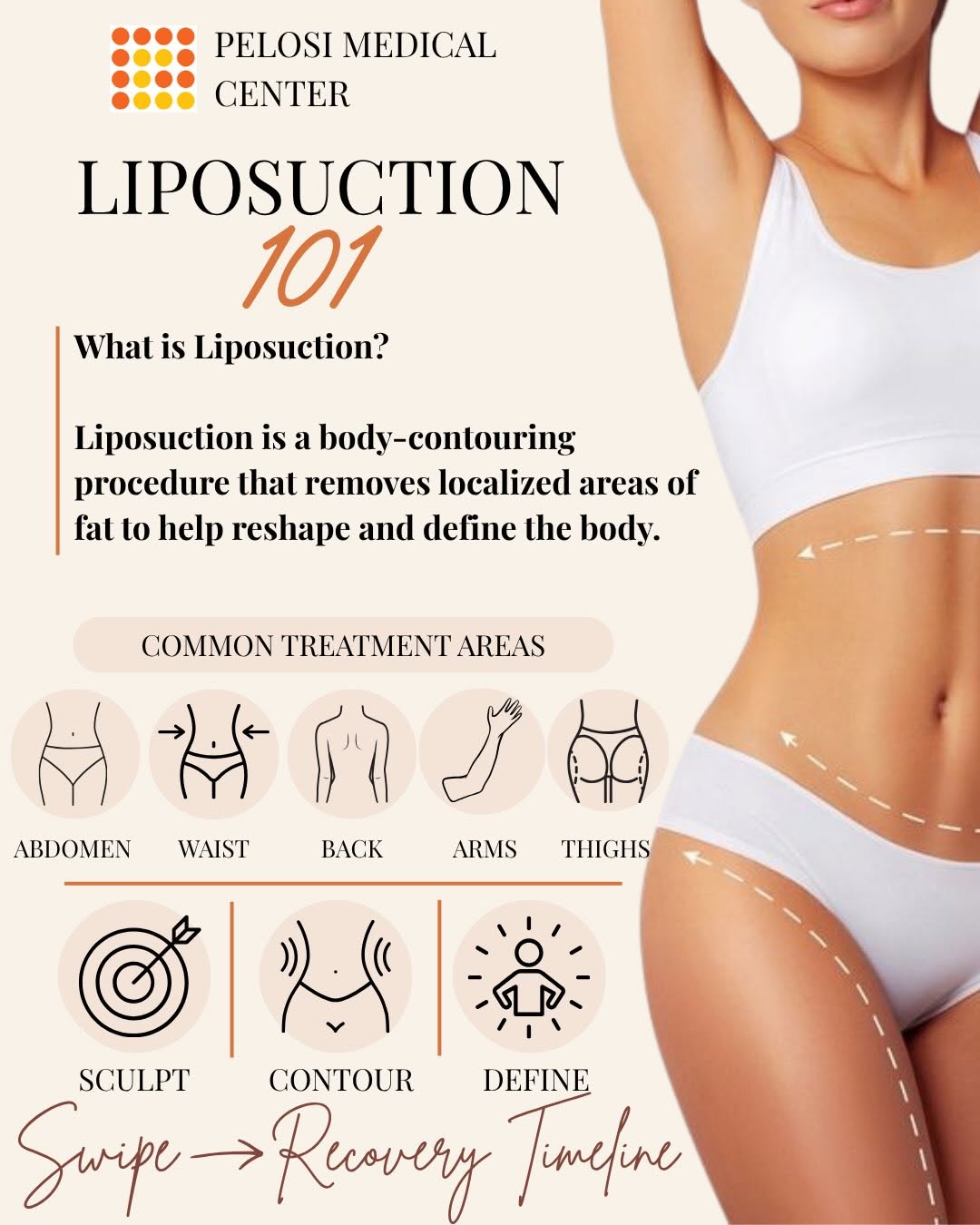 Instagram post by Dr. Marco A. Pelosi II: Liposuction results don’t happen overnight ✨ Trust the process, love the progress. 🤎 Swipe through for your Liposuction 101 recovery timeli…