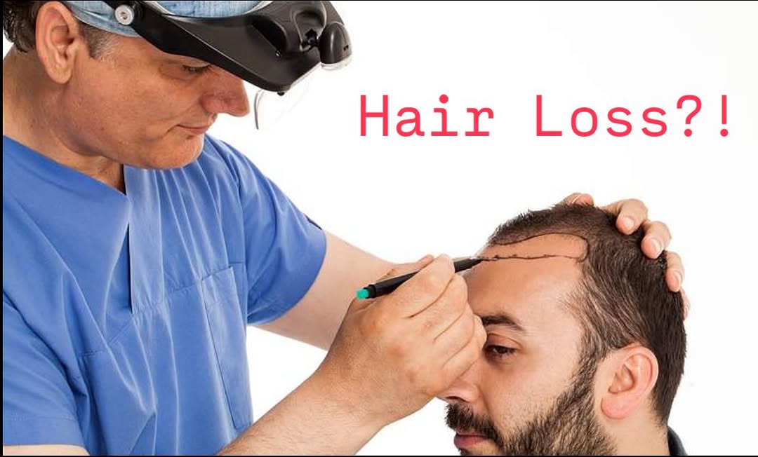 Instagram post by Dr. Marco M. Zahedi: Attention men and woman age 21 to 65 - there are numerous hair loss treatment options available to you that offer effective reversal and res…