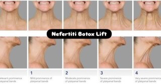 Instagram post by Dr. Marco M. Zahedi: Jawline and Neck contouring with Botox is a commonly missed technique that I love to introduce to my patients who are tenting in the neck ar…